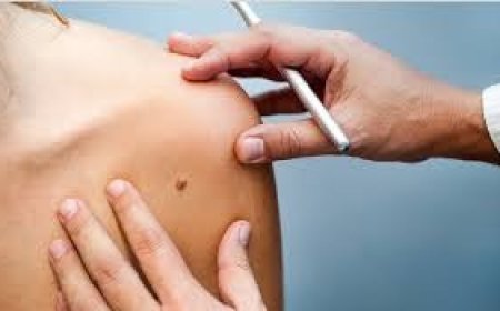 Why Finding a Skin Cancer Dermatologist Near You Matters