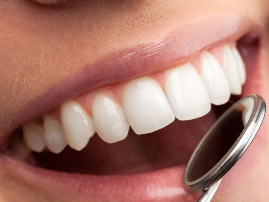 Tooth Crowns in Dubai: The Complete Guide to Restoring Your Smile