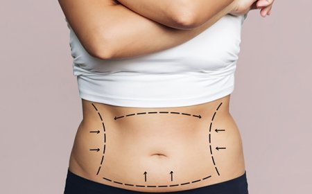 How to Find the Best Tummy Tuck Surgeon in Dubai for Your Needs