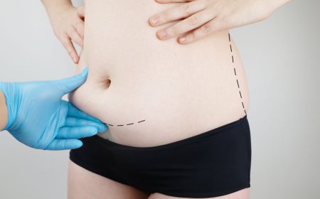 How to Choose the Best Tummy Tuck Surgeon in Dubai for Your Needs